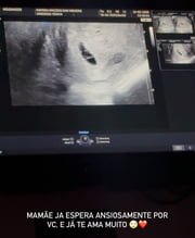 Any Awuada mostrou o ultrassom de seu filho, que poderia ser de Neymar