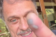 Ator Guilherme Fontes foi mordido por uma jararaca
